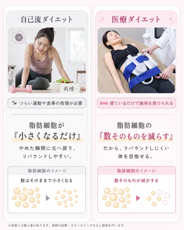自己流ダイエットは脂肪細胞が小さくなるだけでリバウンドしやすい。医療ダイエットは脂肪細胞の数そのものを減らすからリバウンドしにくい体を目指せる